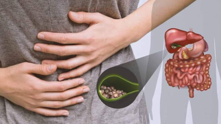 penyakit batu empedu